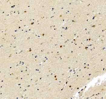 IHC staining of FFPE human brain tissue with FGF2 antibody, HRP-secondary and DAB substrate. HIER: boil tissue sections in pH8 EDTA for 20 min and allow to cool before testing.