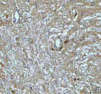 IHC staining of FFPE rat brain tissue with Growth Hormone antibody. HIER: boil tissue sections in pH8 EDTA for 20 min and allow to cool before testing.