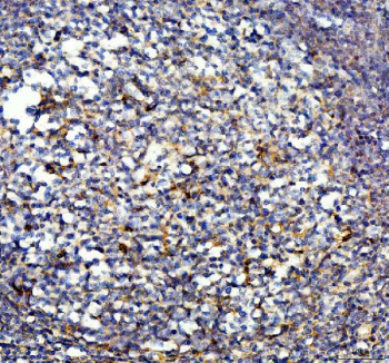 Human IL-10 Antibody Appendix IHC. Immunohistochemistry staining of FFPE human appendix tissue with human IL-10 antibody, HRP-labeled secondary and DAB substrate. HIER: boil tissue sections in pH8 EDTA for 20 min and allow to cool before testing.