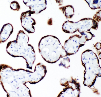 IHC-P: Growth Hormone antibody testing of human placenta tissue