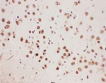 IHC-P: 5-Lipoxygenase antibody testing of mouse brain tissue