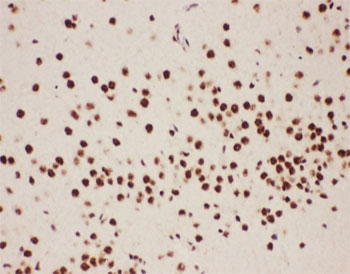 IHC-P: 5-Lipoxygenase antibody testing of rat brain tissue