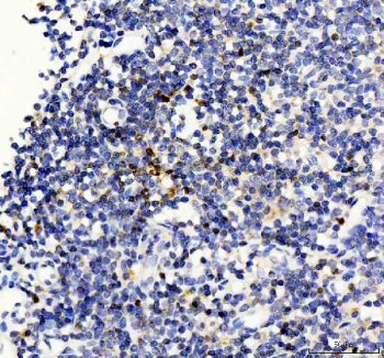 IHC staining of FFPE human tonsil tissue with FOXP3 antibody, HRP-labeled secondary and DAB substrate. HIER: boil tissue sections in pH8 EDTA for 20 min and allow to cool before testing.