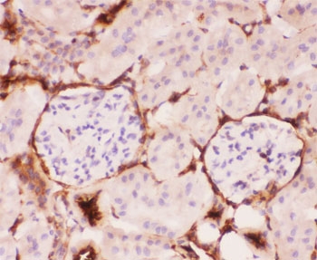 IHC-P: P Glycoprotein antibody testing of mouse kidney tissue. HIER: steam section in pH6 citrate buffer for 20 min.