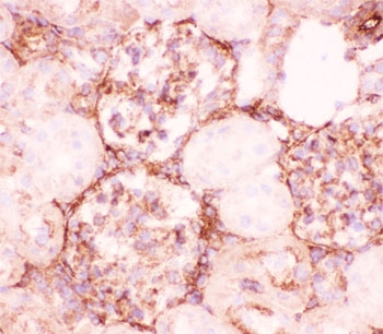 IHC-F testing of rat kidney tissue using P Glycoprotein antibody.
