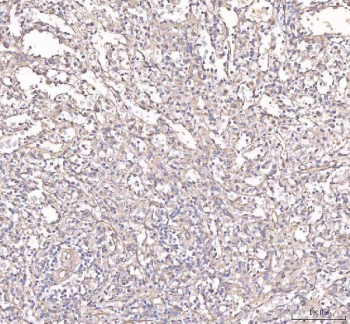 Immunohistochemical staining of FFPE human adrenal adenoma tissue with ANG2 antibody, HRP-secondary and DAB substrate. HIER: boil tissue sections in pH8 EDTA for 20 min and allow to cool before testing.