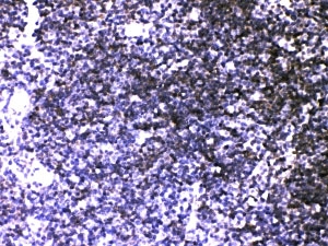 IHC-P: ATP2A3 antibody testing of mouse thymus tissue