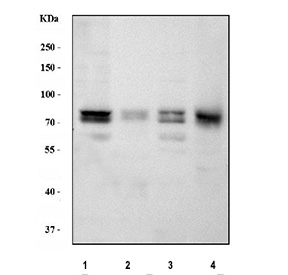 Western blot analysis using PKC delta antibody. Lane 1: rat brain tissue lysates; Lane 2: rat lung tissue lysates; Lane 3: mouse brain tissue lysates; Lane 4: mouse lung tissue lysates. The predicted molecular weight of Protein kinase C delta is ~78 kDa. A doublet is observed at the expected size, consistent with distinct phosphorylation states of PKC delta.