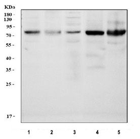 Western blot analysis using PKC delta antibody. Lane 1: human RT-4 cell lysates; Lane 2: human MCF7 cell lysates; Lane 3: human Caco-2 cell lysates; Lane 4: mouse small intestine tissue lysates; Lane 5: mouse ovary tissue lysates. The predicted molecular weight of Protein kinase C delta is ~78 kDa.