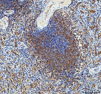 Immunohistochemical staining of FFPE human tonsil tissue with PKC delta antibody, HRP-secondary and DAB substrate. HIER: boil tissue sections in pH8 EDTA for 20 min and allow to cool before testing.