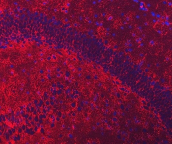 Immunofluorescent staining of FFPE mouse brain tissue with EAAT2 antibody (red) and DAPI nuclear stain (blue). HIER: steam section in pH8 EDTA for 20 min.