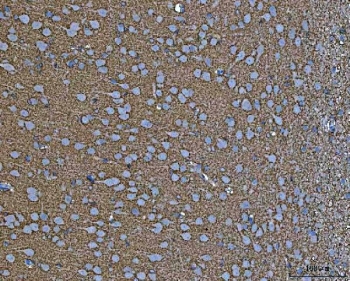 IHC staining of FFPE rat brain tissue with EAAT2 antibody. HIER: boil tissue sections in pH8 EDTA for 20 min and allow to cool before testing.