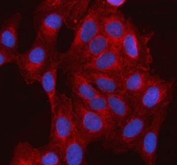Immunofluorescent staining of FFPE human U-2 OS cells with SSH3BP1 antibody (red) and DAPI nuclear stain (blue). HIER: steam section in pH6 citrate buffer for 20 min.
