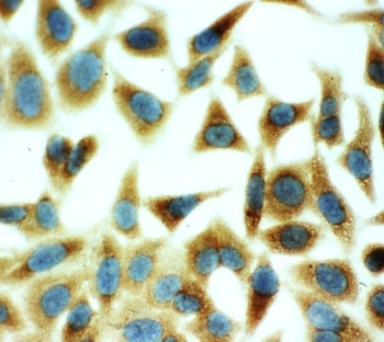 ICC testing of HeLa cells