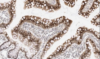 IHC staining of FFPE rat intestine tissue with Apoptosis inhibitor 5 antibody. HIER: boil tissue sections in pH6 citrate buffer for 20 min and allow to cool before testing.