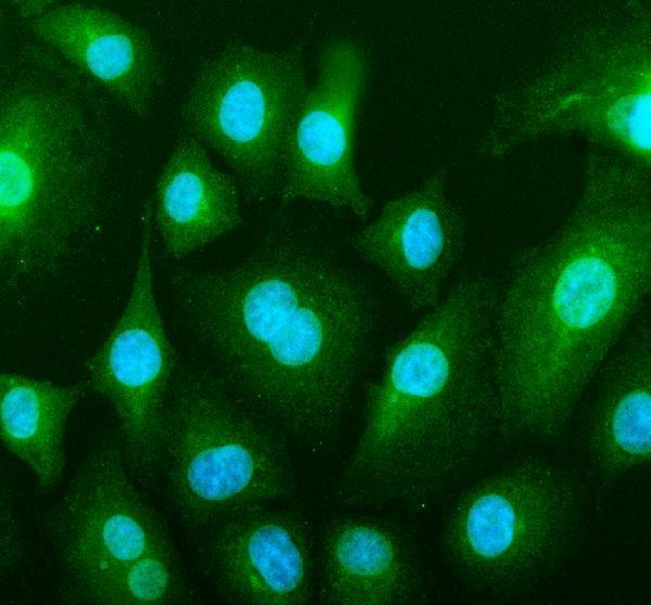 Bax Antibody A549 Cell IF. Immunofluorescent staining of A549 cells with Bax antibody (green) at 5 ug/ml. Enzymatic antigen retrieval was performed for 15 minutes prior to staining. Nuclei are counterstained with DAPI (blue). Bax immunoreactivity is observed predominantly within the cytoplasm, consistent with the expected localization of BCL2 Associated X Protein, a pro-apoptotic BCL2 family member that undergoes stress-induced translocation to the mitochondrial outer membrane to initiate the intrinsic apoptotic pathway.
