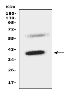 CCR5 Antibody Mouse Liver WB. Western blot analysis of CCR5 Antibody / C-C Chemokine Receptor Type 5 Antibody detected a specific band at approximately 40 kDa in mouse liver tissue lysate, consistent with the predicted molecular weight of approximately 40 kDa. The blot was performed using 50 ug of mouse liver lysate with the antibody at 0.5 ug/ml. The strong, discrete immunoreactive band demonstrates specific recognition of endogenous CCR5 in mouse tissue. This CCR5 Antibody supports western blot studies of C-C Chemokine Receptor Type 5, chemokine signaling, leukocyte trafficking, and inflammatory responses.