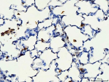 CD44 Antibody Rat Lung IHC. Immunohistochemistry analysis of CD44 / CD44 antigen expression in FFPE rat lung tissue using antibody. Membranous HRP-DAB brown staining is observed in scattered epithelial and interstitial cells, highlighting cell surface localization consistent with CD44 expression. The staining pattern demonstrates regional distribution across alveolar structures and supports its use for evaluating CD44 expression and cellular organization in lung tissue. Heat induced epitope retrieval was performed by boiling tissue sections in pH 8 EDTA for 20 min followed by cooling before testing.