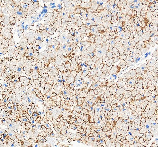 Connexin 43 Antibody Human Myocardium IHC. Immunohistochemical staining of FFPE human heart tissue with Connexin 43 antibody at 2 ug/ml. Heat-induced epitope retrieval (HIER) was performed by boiling tissue sections in pH 8 EDTA buffer prior to staining. Connexin 43 immunoreactivity is observed in a characteristic punctate pattern along adjacent cardiomyocyte membranes throughout the myocardium, consistent with the expected localization of this gap junction protein that facilitates direct intercellular communication, electrical impulse propagation, and synchronized myocardial contraction. Cell nuclei are counterstained with hematoxylin (blue).