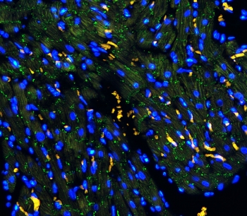 Connexin 43 Antibody Rat Heart IF. Immunofluorescent staining of FFPE rat heart tissue with Connexin 43 antibody (green) at 1 ug/ml. Heat-induced epitope retrieval (HIER) was performed by boiling tissue sections in pH 6, 10 mM citrate buffer for 10â20 minutes and allowing them to cool prior to staining. Nuclei are counterstained with DAPI (blue). Connexin 43 immunoreactivity is observed in a punctate distribution along cardiomyocyte cell borders, consistent with the expected localization of this gap junction protein that forms intercellular channels essential for electrical coupling and coordinated cardiac contraction.