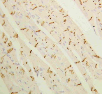 Connexin 43 Antibody Rat Heart IHC. Immunohistochemical staining of FFPE rat heart tissue with Connexin 43 antibody at 1 ug/ml. Heat-induced epitope retrieval (HIER) was performed by boiling tissue sections in pH 6, 10 mM citrate buffer for 10â20 minutes and allowing them to cool prior to staining. Connexin 43 immunoreactivity is observed in a punctate pattern at cardiomyocyte cell borders, consistent with the expected localization of this gap junction protein that forms intercellular channels essential for electrical coupling and synchronized cardiac contraction. Cell nuclei are counterstained with hematoxylin (blue).