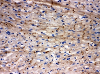 Cx43 Antibody Frozen Rat Heart IHC. Immunohistochemical staining of frozen rat heart tissue with Cx43 antibody. Cx43 immunoreactivity is observed in a punctate distribution along cardiomyocyte cell borders, consistent with the expected localization of this gap junction protein that forms intercellular channels essential for electrical coupling and synchronized cardiac contraction. Cell nuclei are counterstained with hematoxylin (blue).