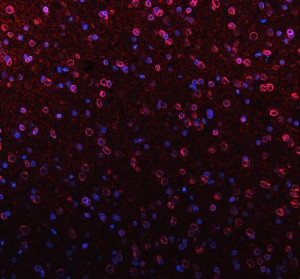 Lamin B1 Antibody Rat Brain IF. Immunofluorescent staining of FFPE rat brain tissue with Lamin B1 Antibody at 5 ug/ml. HIER was performed using pH 8 EDTA buffer, followed by blocking with 10% goat serum. The tissue section was incubated with rabbit anti-Lamin B1 antibody overnight at 4Â°C, followed by Cy3 conjugated goat anti-rabbit IgG secondary antibody (red). Nuclei were counterstained with DAPI (blue). Lamin B1 Antibody / Nuclear Envelope Marker Antibody demonstrates nuclear envelope staining consistent with LMNB1 localization and supports studies of nuclear lamina organization, nuclear architecture and chromatin-associated cellular regulation pathways.