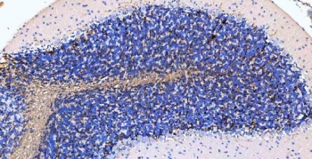IHC-P: MBP antibody testing of rat cerebellum tissue. HIER: boil tissue sections in pH8 EDTA buffer for 10-20 min and allow to cool before testing.