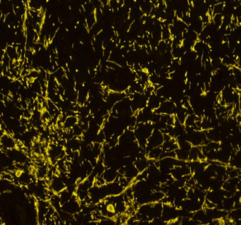 IHC staining of rat brain tissue with MBP antibody (yellow), HRP secondary and TSA 570 reagent. HIER: boil tissue sections in pH8 EDTA buffer for 10-20 min and allow to cool before testing.