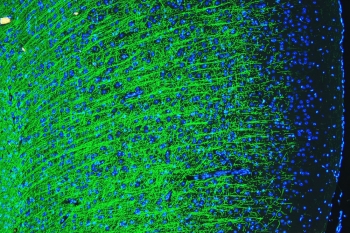 Immunofluorescent staining of FFPE rat brain with MBP antibody (green) at 2ug/ml and DAPI nuclear stain (blue). HIER: steam section in pH6 citrate buffer for 20 min.