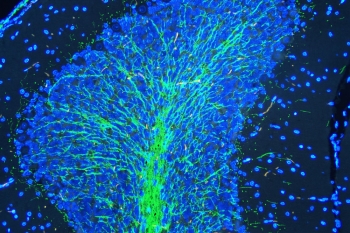 Immunofluorescent staining of FFPE rat brain with MBP antibody (green) at 2ug/ml and DAPI nuclear stain (blue). HIER: steam section in pH6 citrate buffer for 20 min.