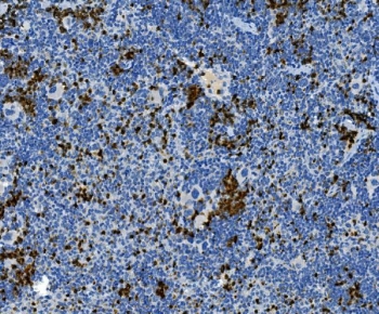 Myeloperoxidase Antibody Mouse Spleen IHC. Immunohistochemistry staining of FFPE mouse spleen tissue with Myeloperoxidase antibody. HIER: boil tissue sections in pH8 EDTA for 20 min and allow to cool before testing.