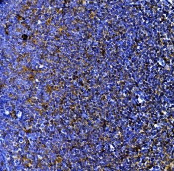 Myeloperoxidase Antibody Rat Lymph Tissue IHC. Immunohistochemistry staining of FFPE rat lymph tissue with Myeloperoxidase antibody. HIER: boil tissue sections in pH8 EDTA for 20 min and allow to cool before testing.