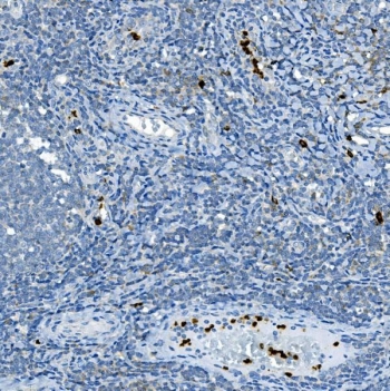 Myeloperoxidase Antibody Tonsil Tissue IHC. Immunohistochemistry staining of FFPE human tonsil tissue with Myeloperoxidase antibody. HIER: boil tissue sections in pH8 EDTA for 20 min and allow to cool before testing.