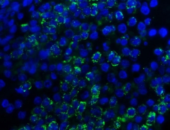 Myeloperoxidase Antibody for IF / MPO Immunofluorescence Antibody. Immunofluorescence analysis of Myeloperoxidase / MPO in FFPE human spleen tissue using Myeloperoxidase Antibody for IF. Bright granular cytoplasmic fluorescence (green) highlights MPO-positive myeloid cells within the splenic tissue, while nuclei are counterstained with DAPI (blue). Heat-induced epitope retrieval was performed by steaming sections in pH8 EDTA buffer for 20 minutes prior to staining.