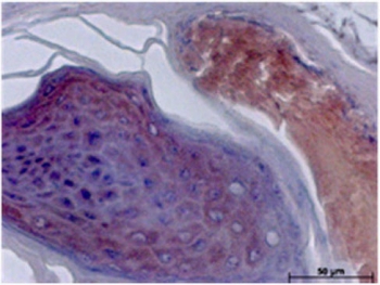 NSE Antibody Mouse Skin IHC. Immunohistochemistry testing of FFPE mouse skin with NSE antibody. Additional testing information can be found in Schmidt, Anke, et al. One Year Follow-Up Risk Assessment in SKH-1 Mice and Wounds Treated with an Argon Plasma Jet. International Journal of Molecular Sciences 18.4 (2017): 868.