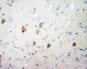 NSE Antibody Rat Brain IHC. Immunohistochemistry testing of FFPE rat brain with NSE antibody. HIER: boil tissue sections in pH6, 10mM citrate buffer, for 20 min and allow to cool before testing.