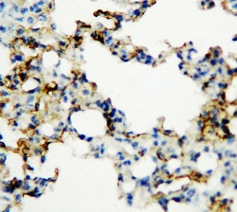IHC-P: RAGE antibody testing of rat lung tissue