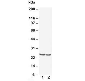 Western blot testing of TIMP4 antibody and Lane 1:  rat kidney;  2: human MCF-7;  Predicted/observed molecular weight: ~25 kDa.