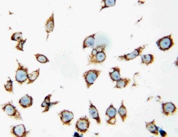 ICC staining of human SMMC-7721 cells with HSP60 antibody.