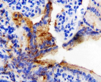 IHC staining of FFPE rat intestine tissue with HSP60 antibody. HIER: boil tissue sections in pH6 citrate buffer for 20 min and allow to cool before testing.