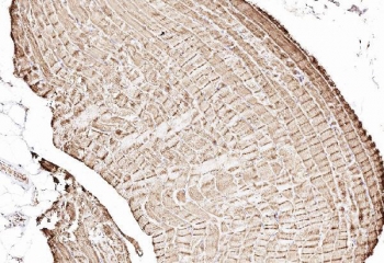 IHC staining of FFPE human skeletal muscle with Cytochrome C antibody. HIER: steam section in pH6 citrate buffer for 20 min.