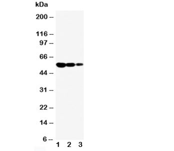 Western blot testing of CD95/Fas antibody and Lane 1:  recombinant mouse protein 10ng;  2: 5ng;  3: 2.5ng