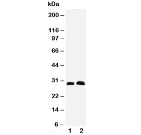 Aquaporin 5 Antibody Rat Lung and Testis WB. Western blot testing of Aquaporin 5 antibody and Lane 1:  rat lung;  2: rat testis tissue lysate. Predicted molecular weight ~28 kDa.