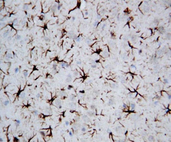 IHC-P: GFAP antibody testing of rat brain tissue. HIER: steam section in pH6 citrate buffer for 20 min and allow to cool prior to staining.