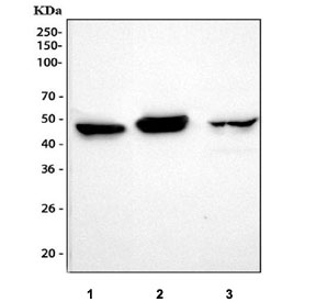 Western blot testing of 1) human U-251, 2) rat brain and 3) mouse brain tissue lysate with GFAP antibody. Predicted molecular weight ~50 kDa.