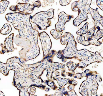 Immunohistochemistry analysis of TFPI2 / Tissue factor pathway inhibitor 2 antibody in human placental tissue. Formalin-fixed, paraffin-embedded placenta demonstrates extracellular and pericellular HRP-DAB brown staining outlining chorionic villi and trophoblastic structures, consistent with matrix-associated TFPI2 expression. Hematoxylin counterstain highlights nuclei and villous architecture. Heat-induced epitope retrieval was performed by boiling tissue sections in pH 8 EDTA for 20 minutes followed by cooling prior to staining.