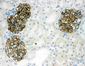 Podocin Antibody Rat Kidney Glomerulus IHC. Immunohistochemistry staining of frozen rat kidney tissue was performed with Podocin Antibody at 1 ug/ml overnight at 4oC. Biotinylated goat anti-rabbit IgG and streptavidin-biotin complex with DAB were used for detection. Strong podocin staining is localized to the renal glomeruli, with minimal staining in the surrounding tubular tissue. This Podocin Antibody demonstrates the characteristic glomerular distribution of NPHS2 and supports its use as a glomerular podocyte marker.