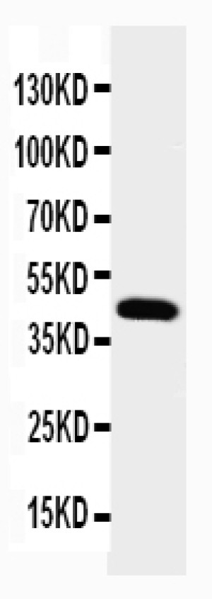 Podocin Antibody Rat Kidney WB. Western blot analysis was performed with Podocin Antibody on rat kidney tissue lysate under reducing conditions. The antibody was used at 0.5 ug/ml overnight at 4oC. A specific band is detected at approximately 45 kDa, consistent with the expected molecular weight of approximately 42 kDa for podocin/NPHS2. This Podocin Antibody demonstrates detection of NPHS2 in rat kidney tissue and supports its use for studies of glomerular podocyte biology and slit diaphragm organization.