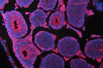 Immunofluorescent staining of FFPE mouse testis tissue with N-Cadherin antibody (red) and DAPI nuclear stain (blue). HIER: steam section in pH8 EDTA for 20 min.